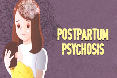  An illustration of a woman going through postpartum