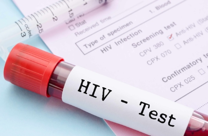 Ghana records 34,000 new HIV infections in the first nine months of 2024 - GHS